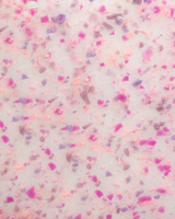 Ishi iPhone Case in Hubba Bubba (Limited Edition)